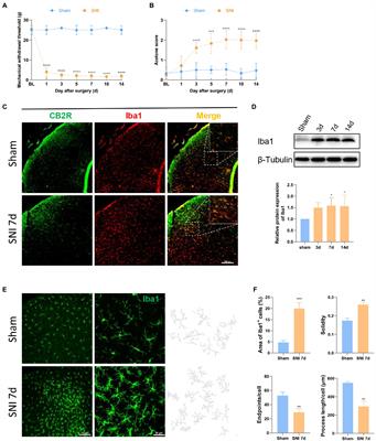 Spinal cannabinoid receptor 2 activation alleviates neuropathic pain by regulating microglia and suppressing P2X7 receptor